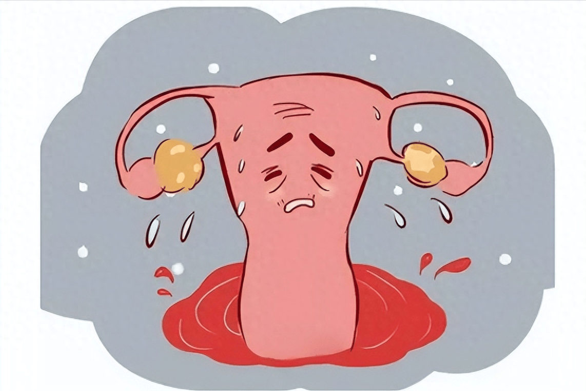 女性内分泌失调常见的症状