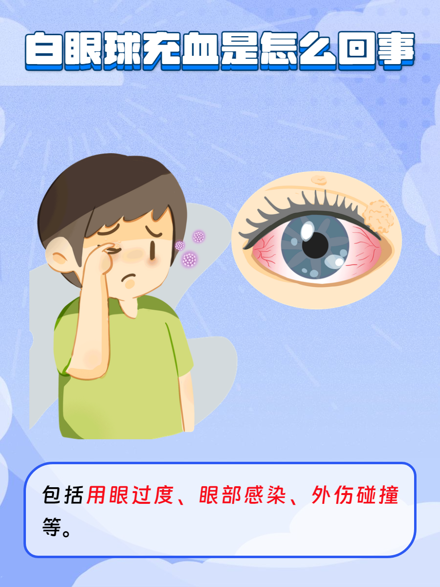 眼睛充血是有哪些原因导致