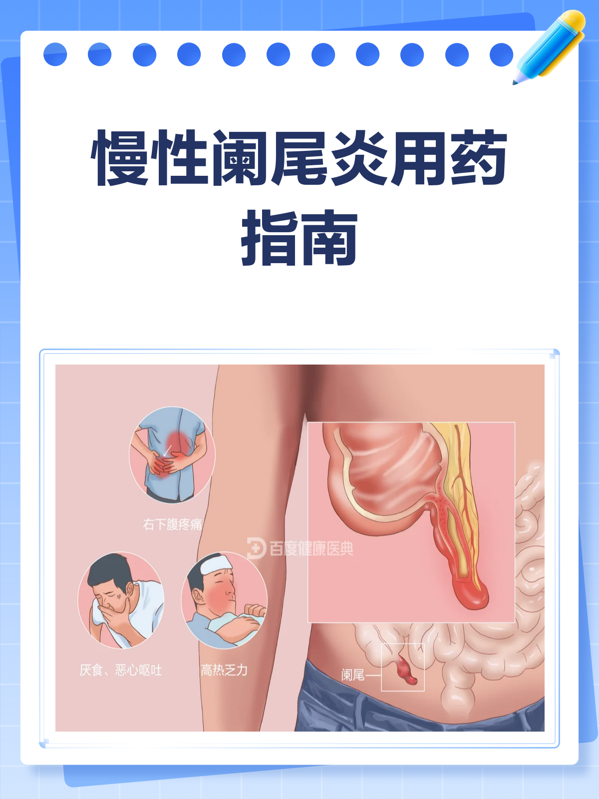 阑尾炎吃什么消炎药