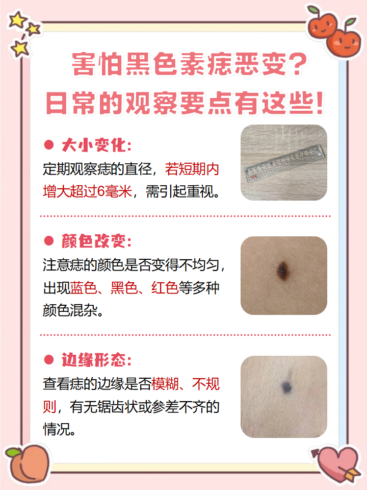 为什么会长黑痣?