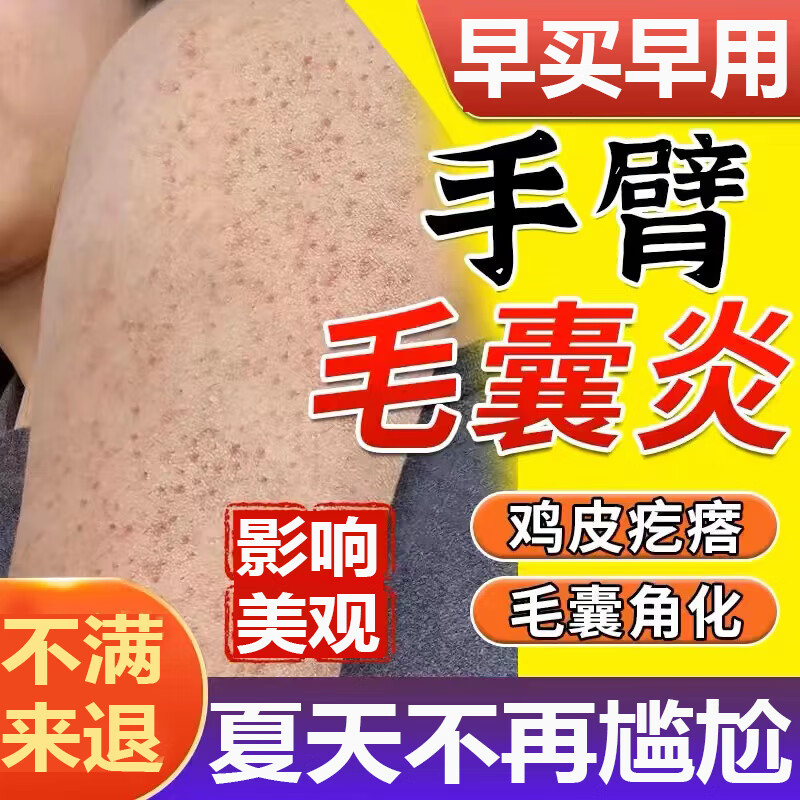 手臂上有很多小疙瘩怎么办
