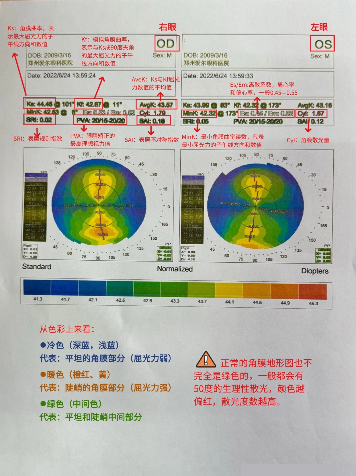 角膜厚度以那个数据为准