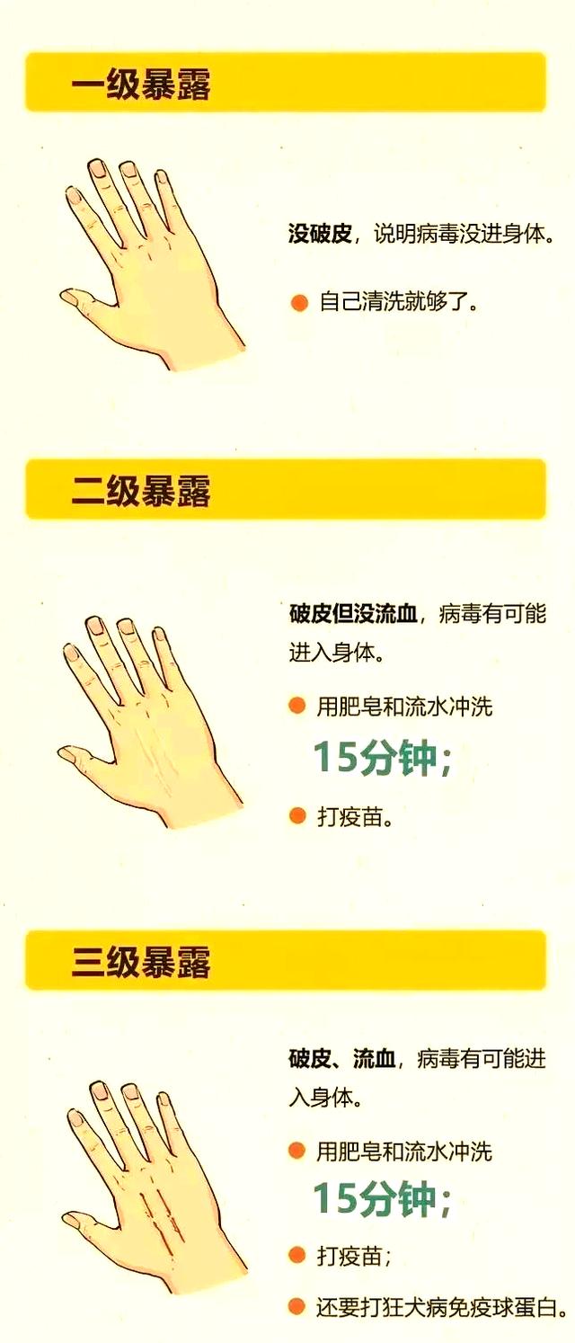 狂犬病的潜伏期