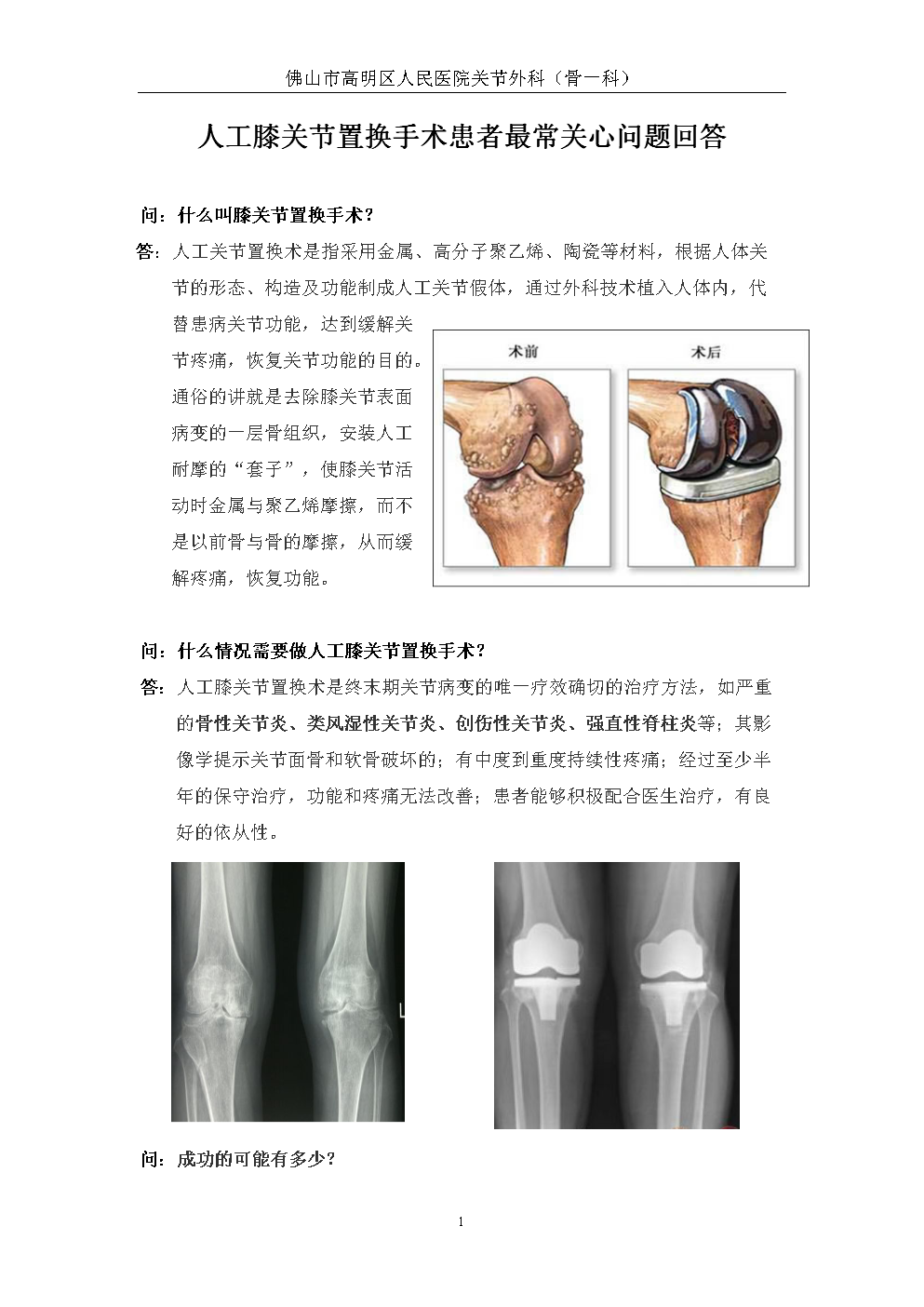 人工关节置换术价格是多少