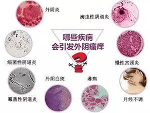 阴道炎有什么治疗方法?