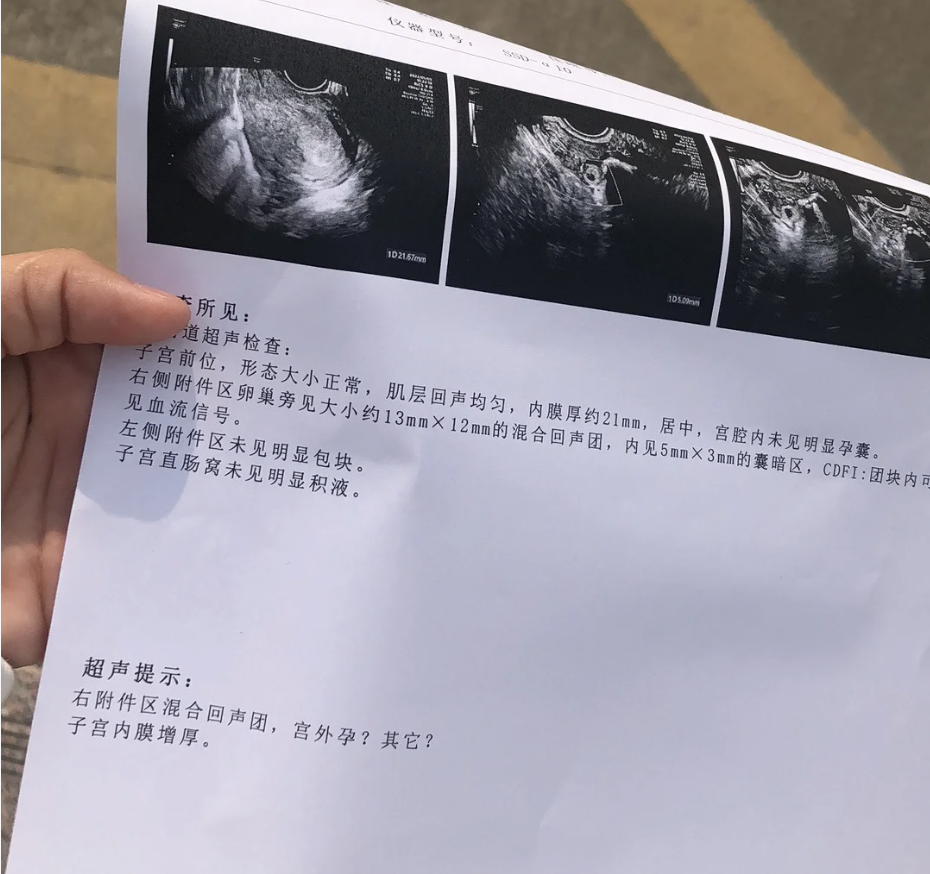 输卵管通而不畅能怀孕吗