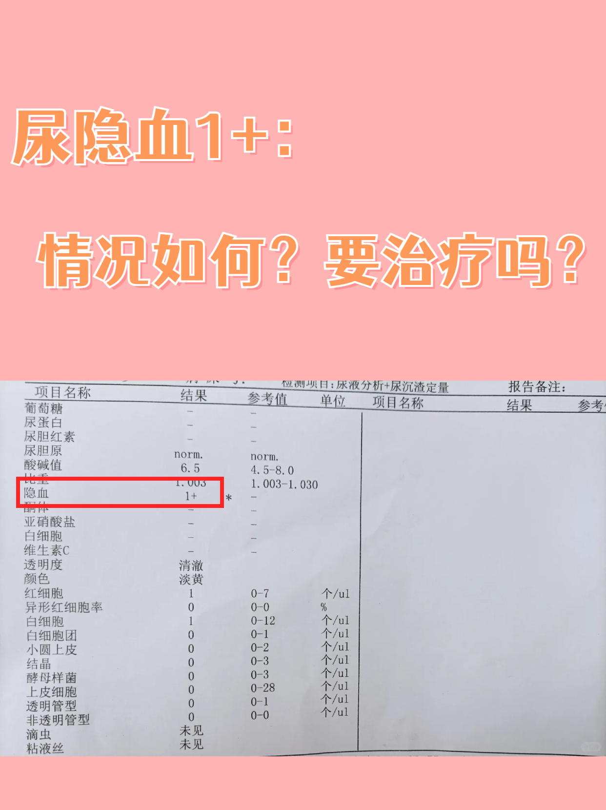 女性尿液发红怎么回事