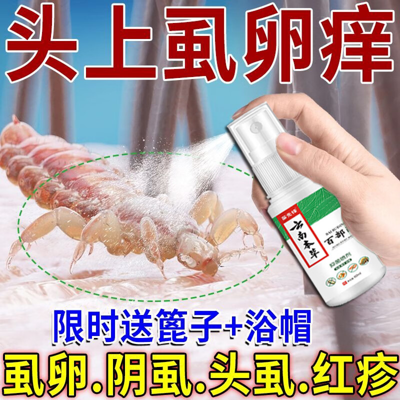 孩子头上有虱子,怎么办