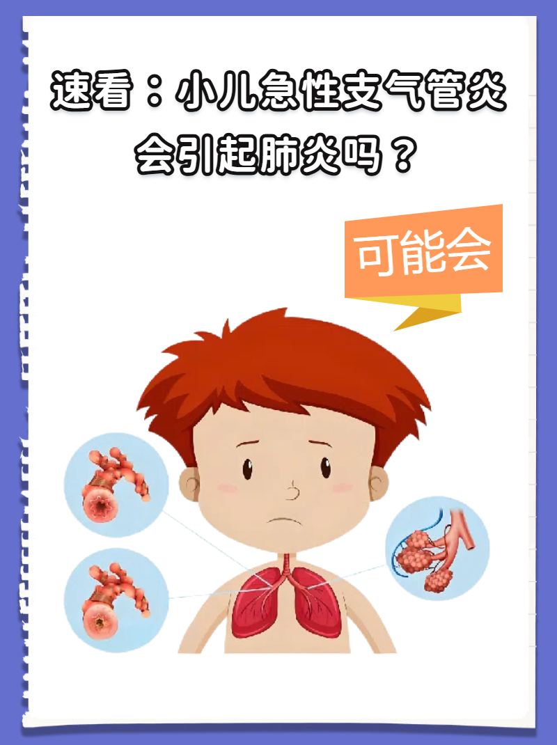小孩子支气管炎应该如何治疗