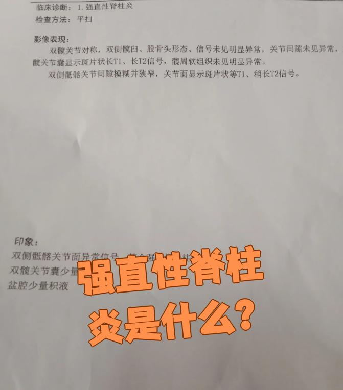 什么是脊柱炎?