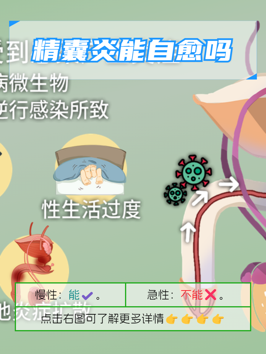 精囊炎的一般症状表现有什么