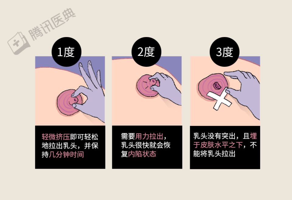 奶头过小怎么办!!!!!!!!