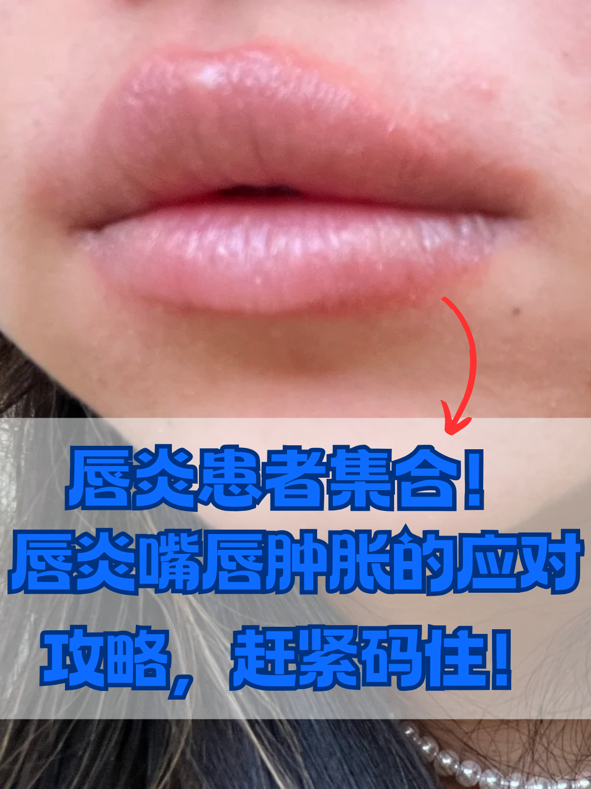 嘴唇痒怎么回事?