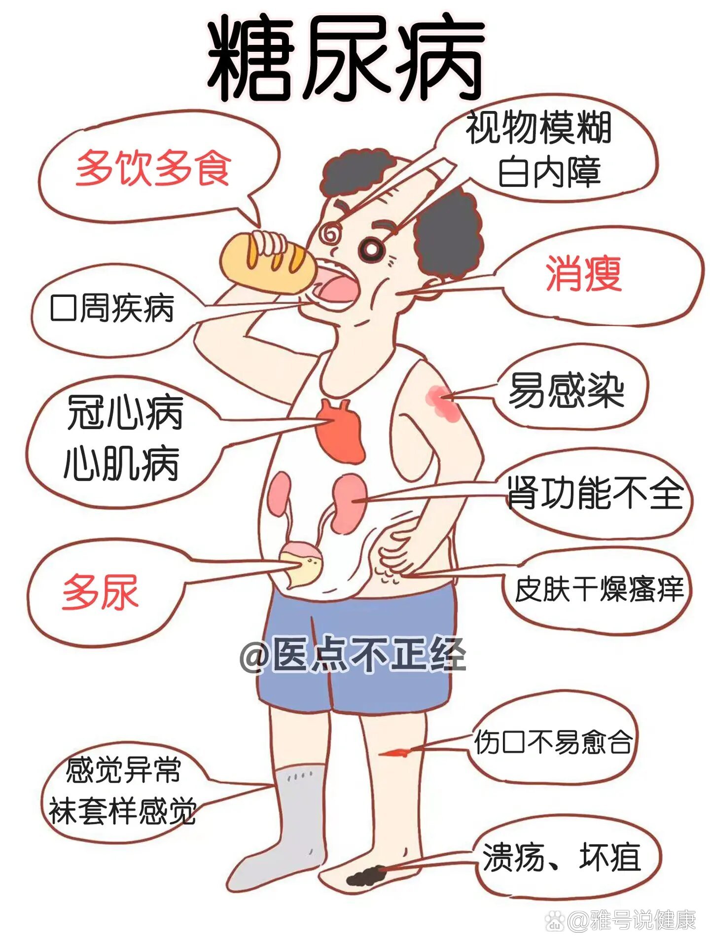 糖尿病三多一少是什么意思