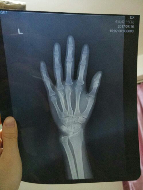骨垢线检查要多少钱?