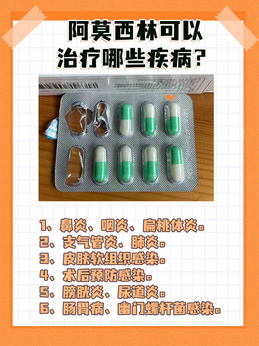 阿莫西林可以外敷吗