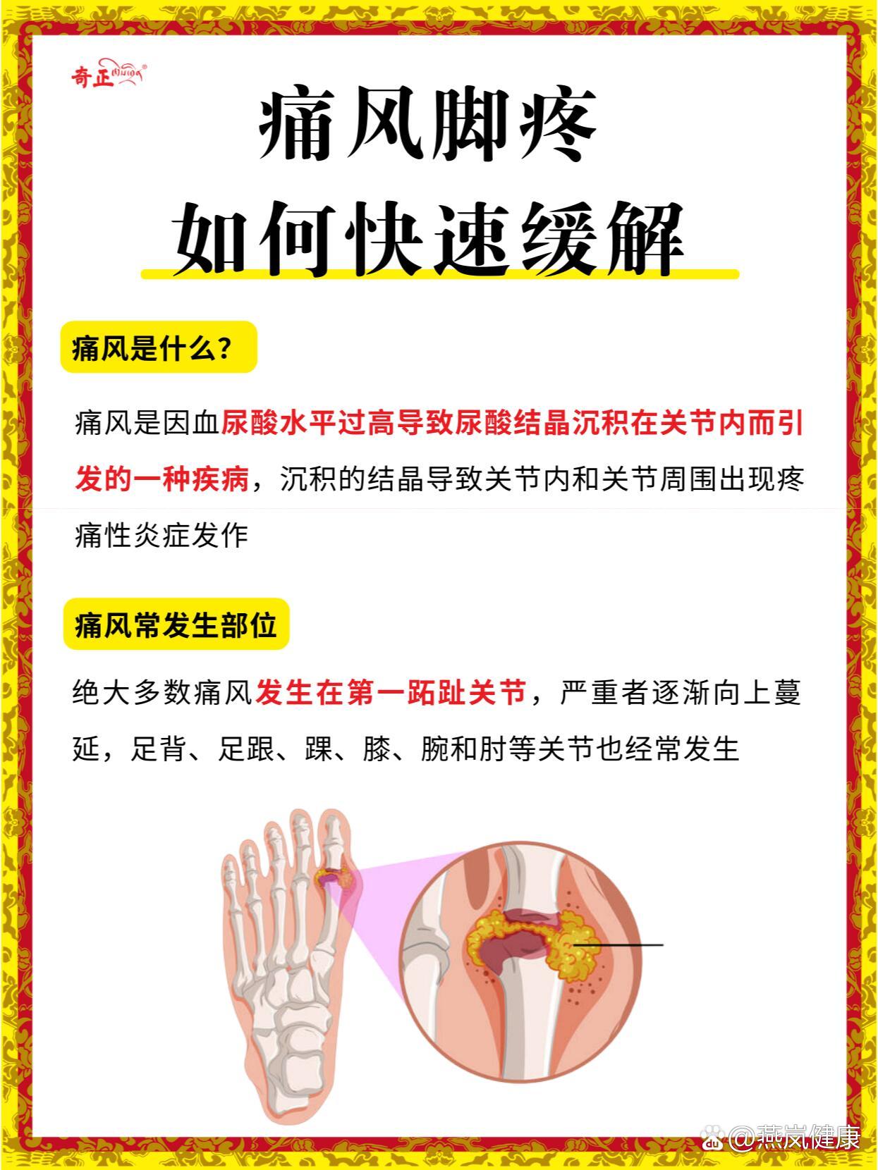 脚肿怎么消肿