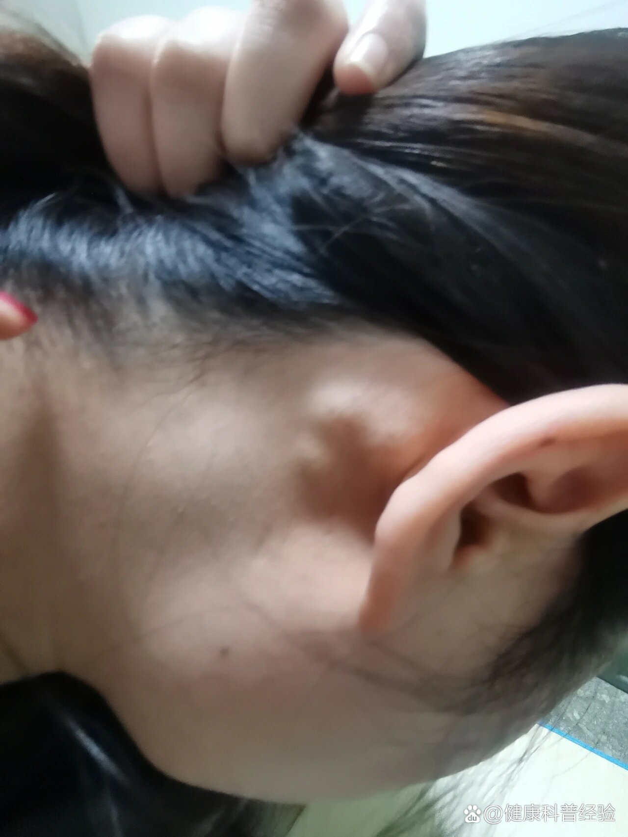 耳朵后面长了个软包,什么情况