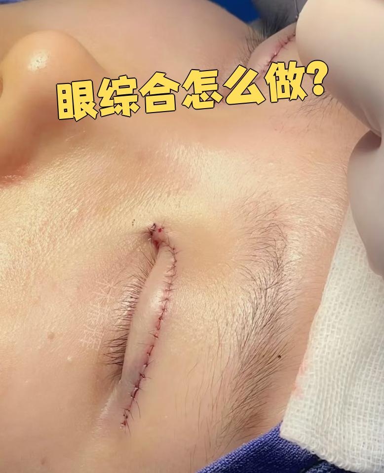 眼部整形修复手术