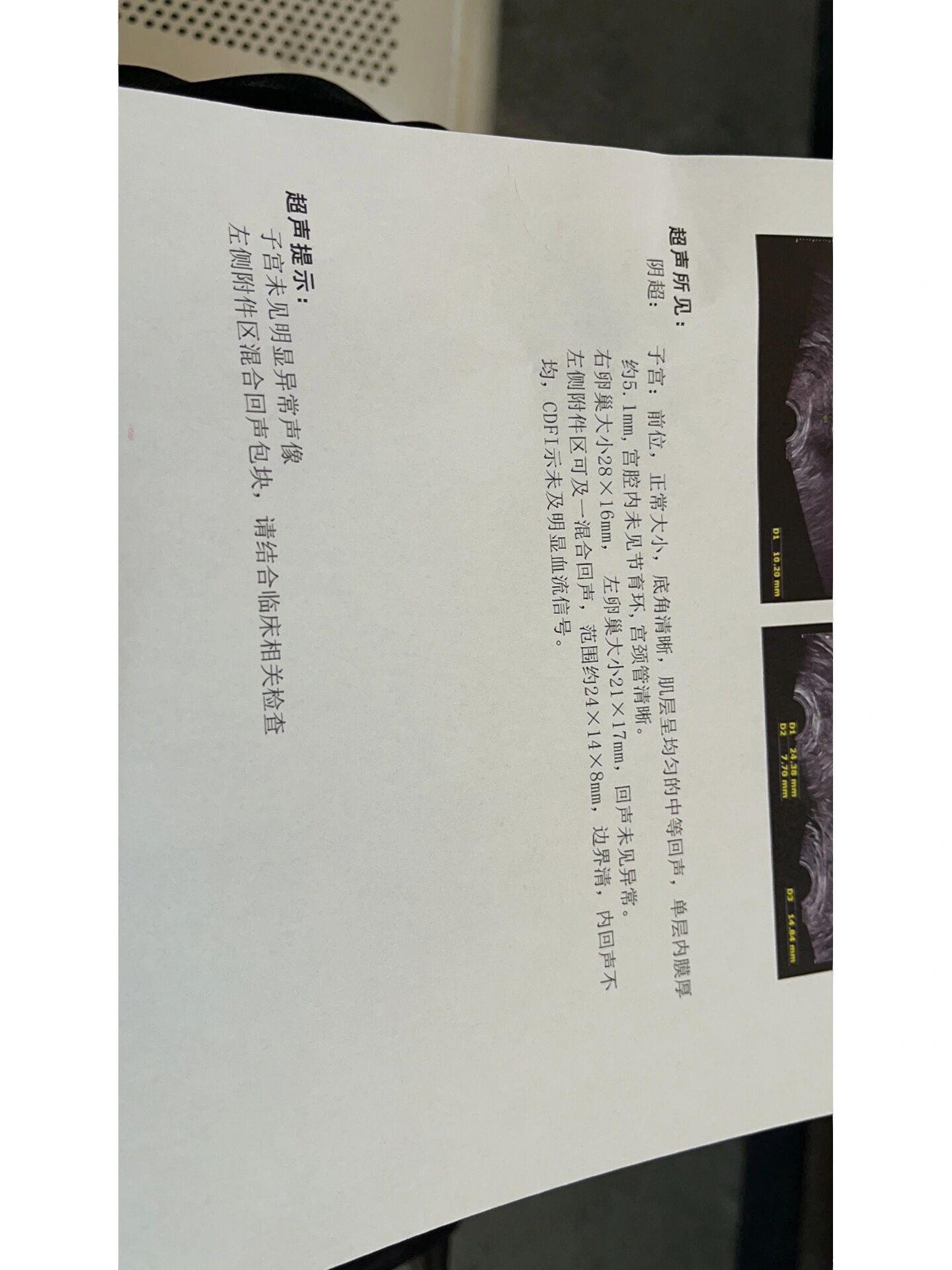 宫外孕一个月怎么打掉