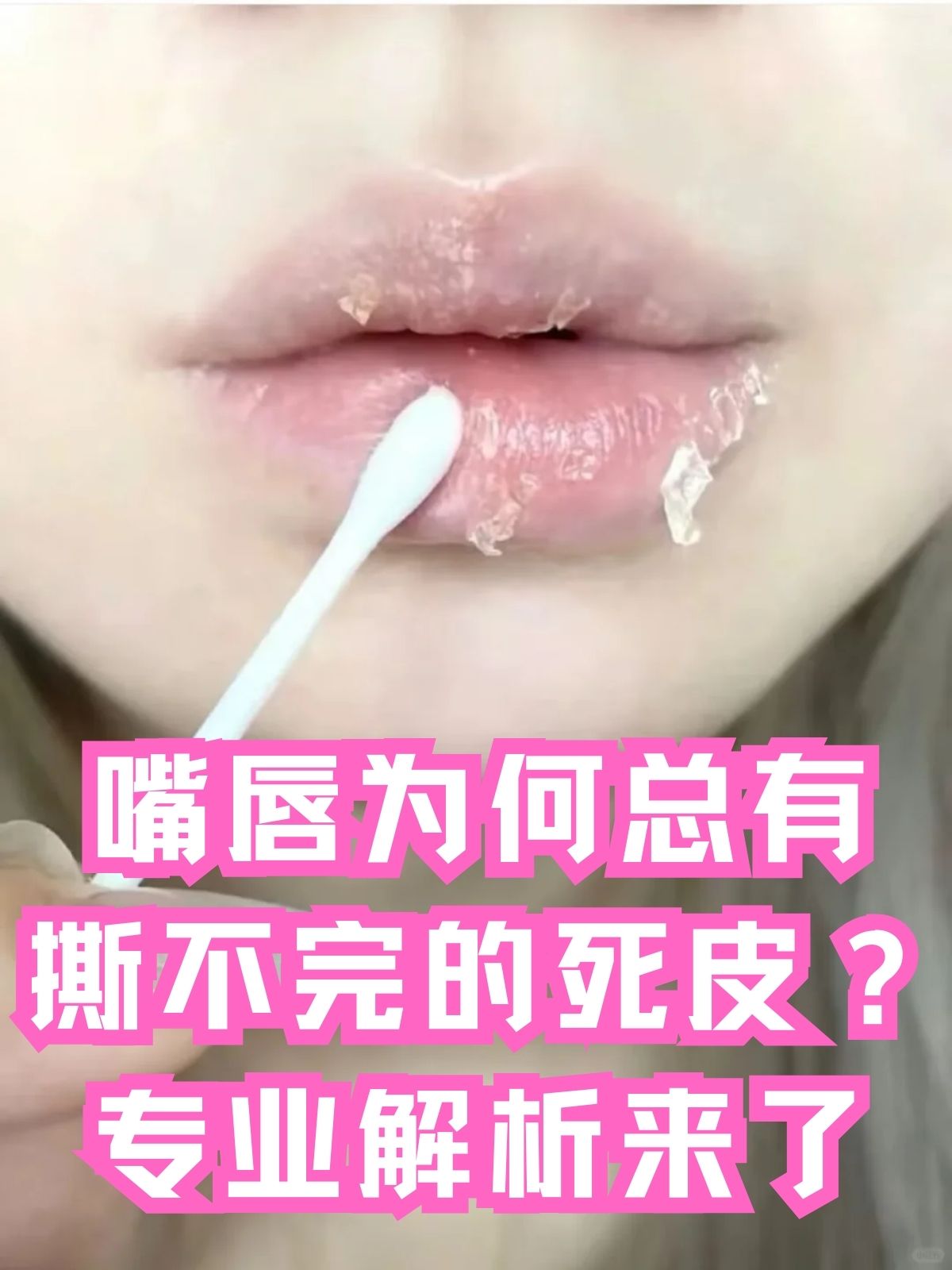 嘴发酸是怎么回事?