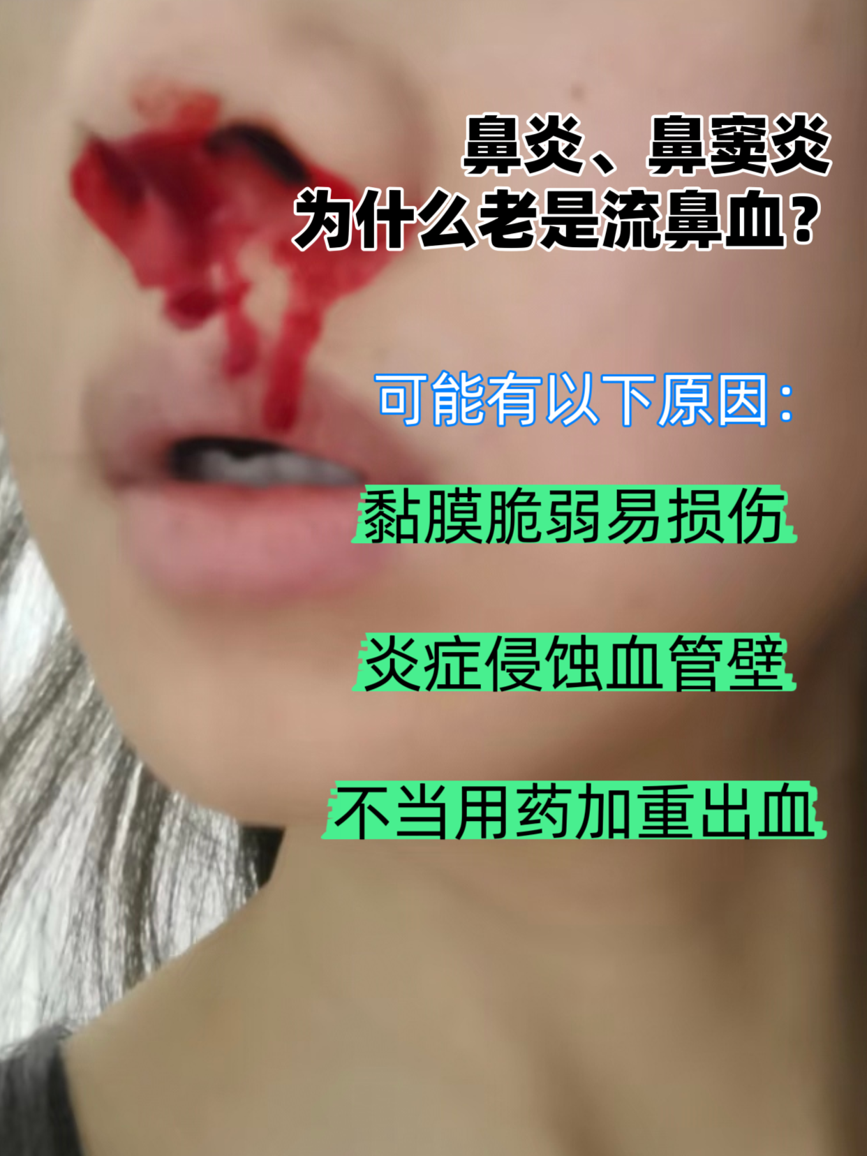 老年人鼻子出血是什么原因