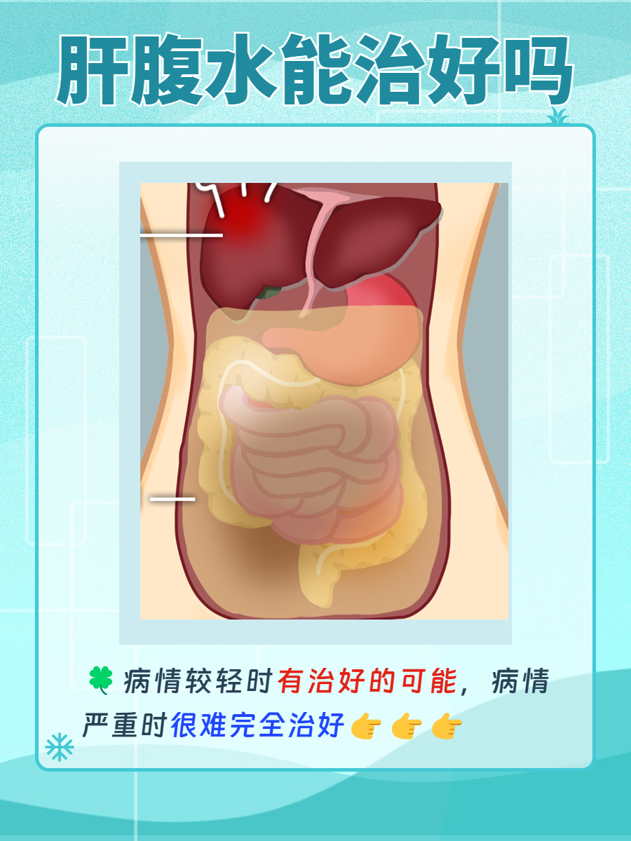肝腹水一般能治好吗?
