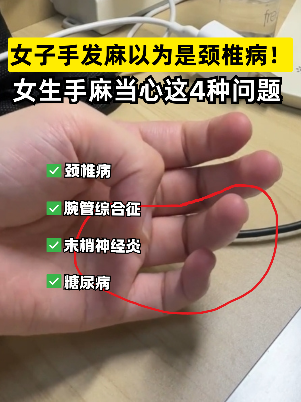 手发麻如何治疗