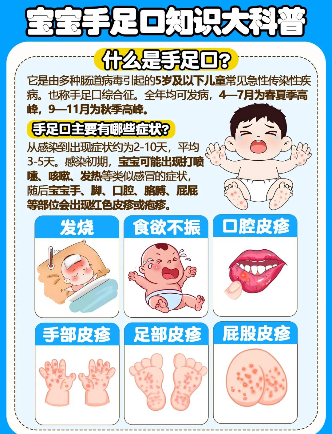 手足口病能洗澡吗