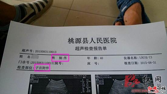 b超子宫大小正常范围