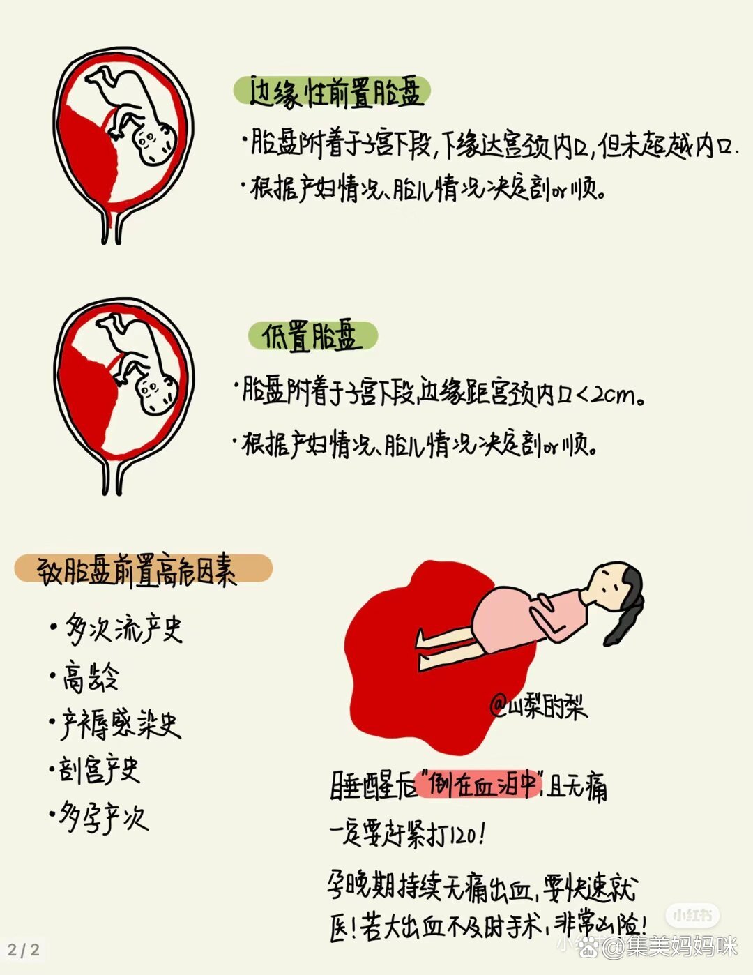 前置胎盘与后置胎盘的区别