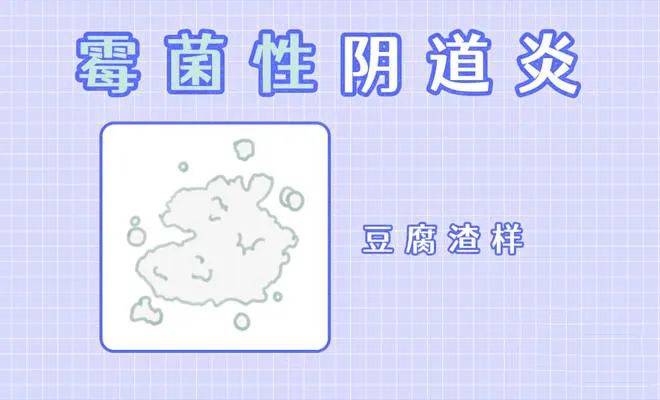 念珠菌性阴炎是怎么引起的