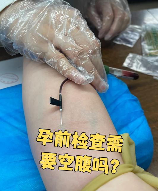 怀孕检查需要空腹吗