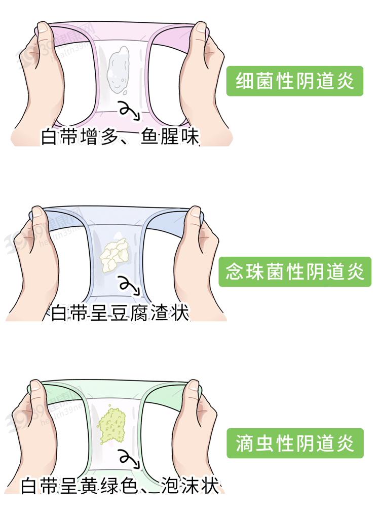引起细菌性阴道炎的病因有哪些
