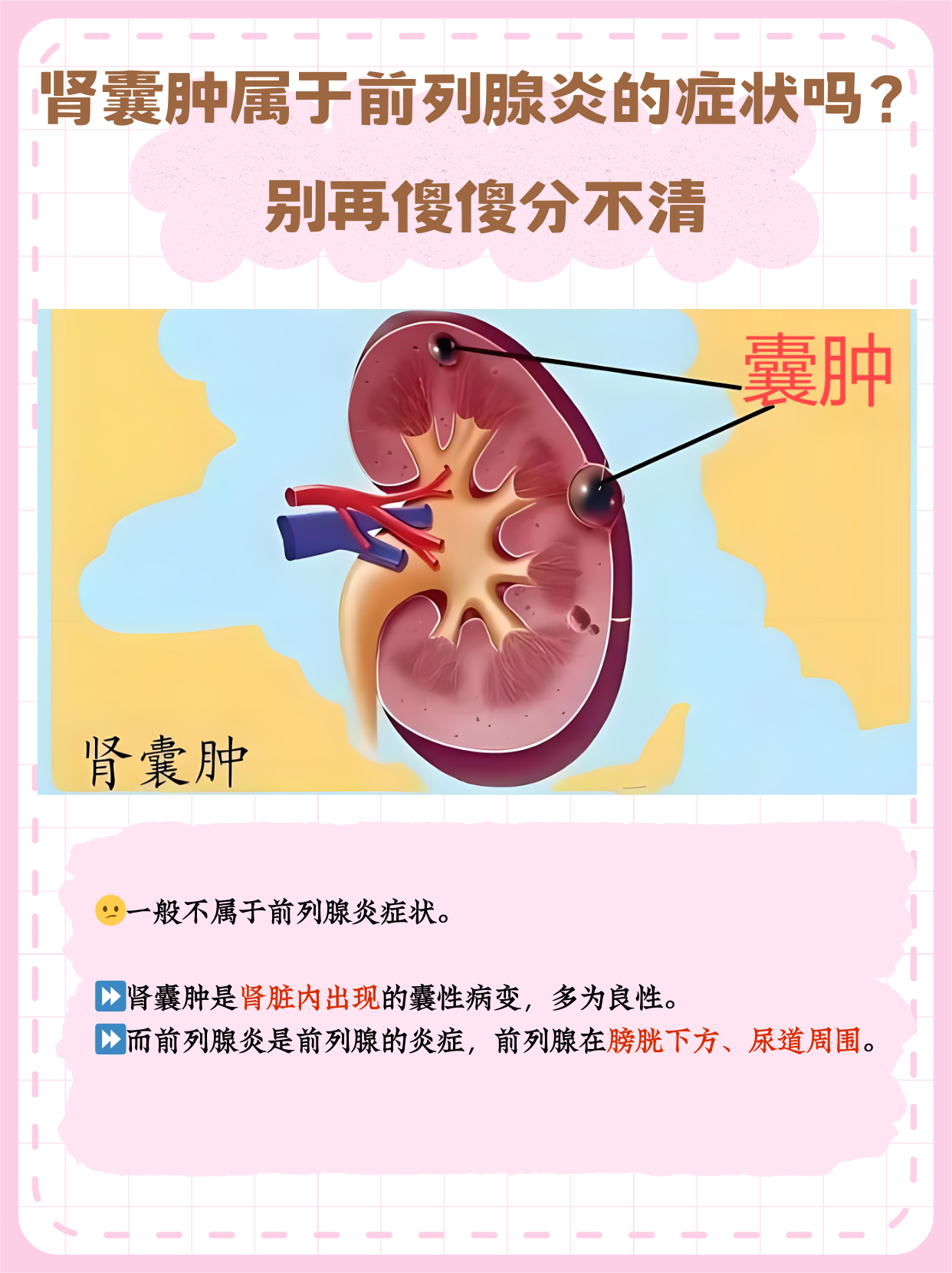 肾囊肿严重吗