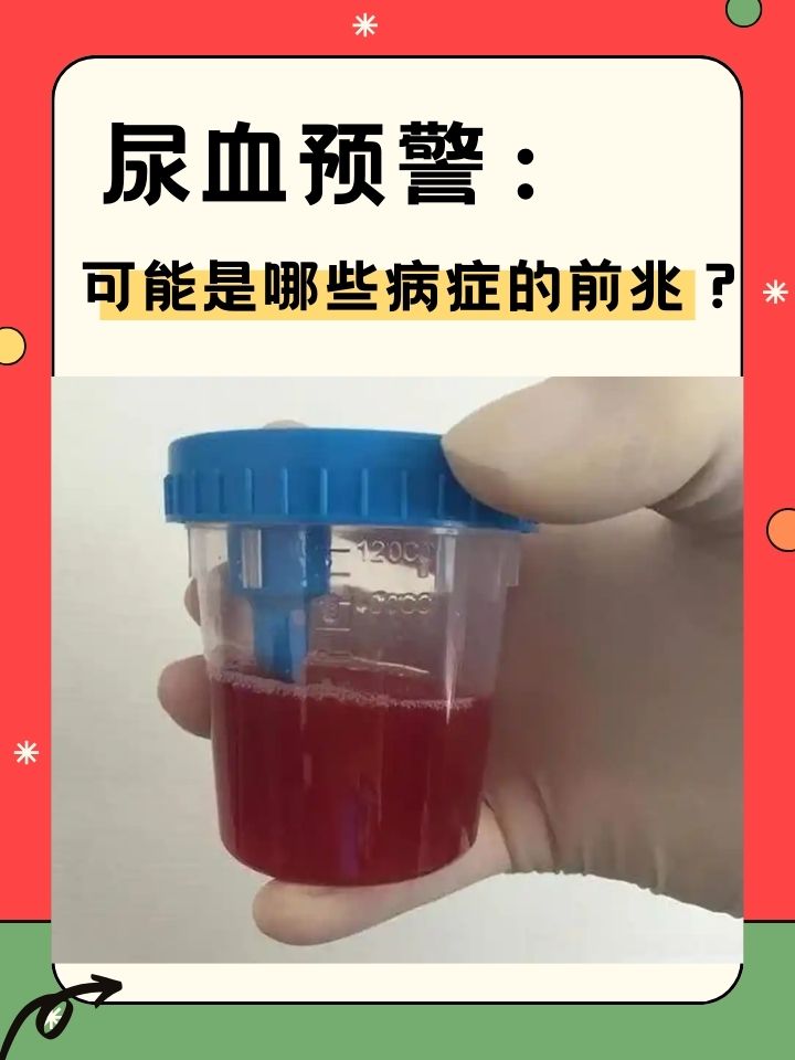 血尿是什么颜色