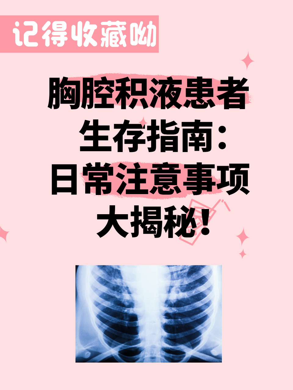 怎样治疗胸腔积液