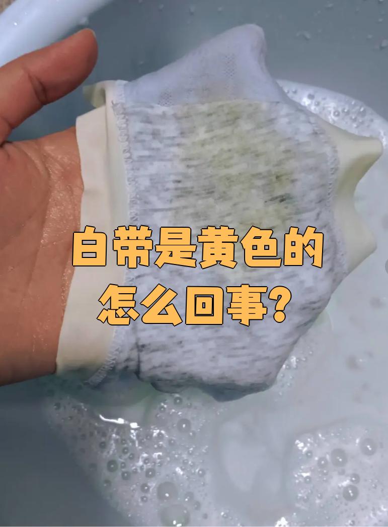 白带多发黄是什么情况