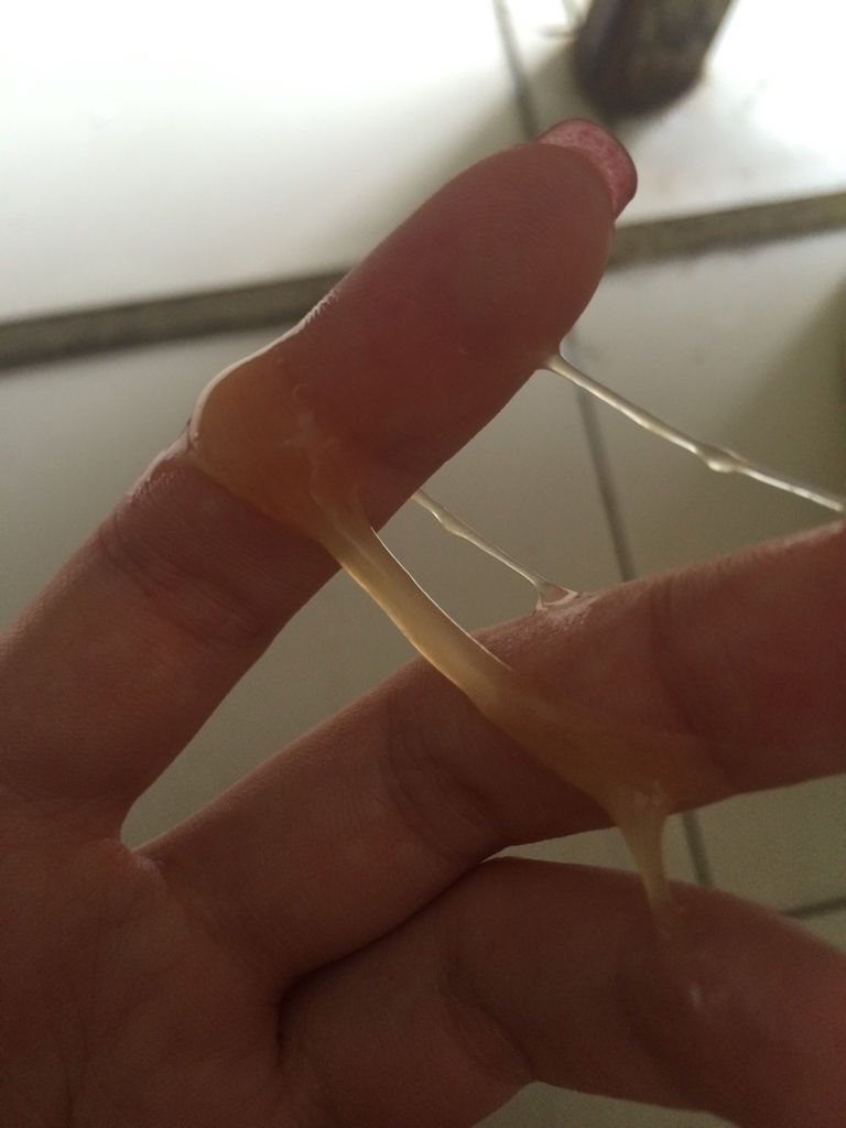 白带多发黄是什么情况