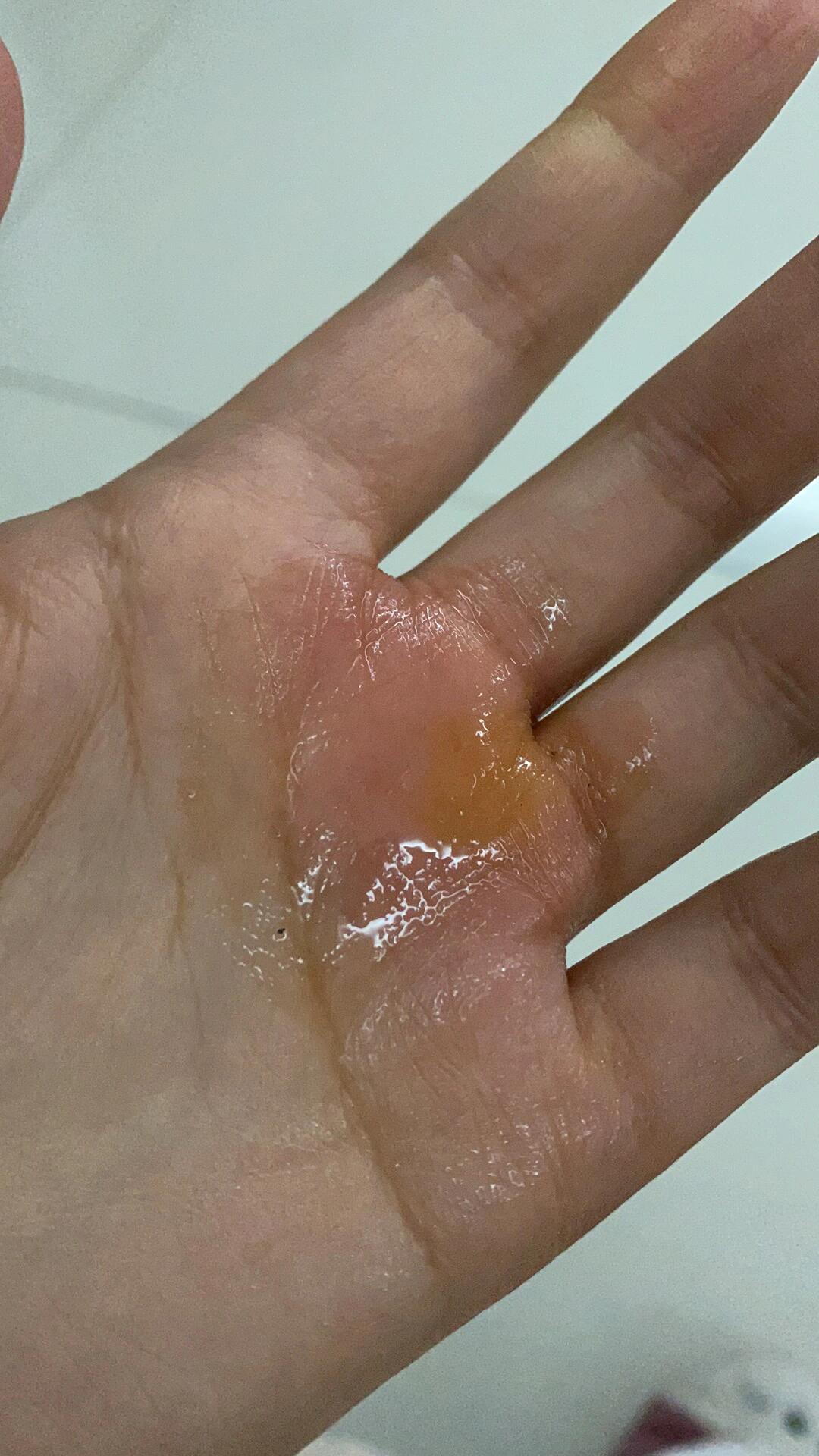 手被蜜蜂蛰了怎么办
