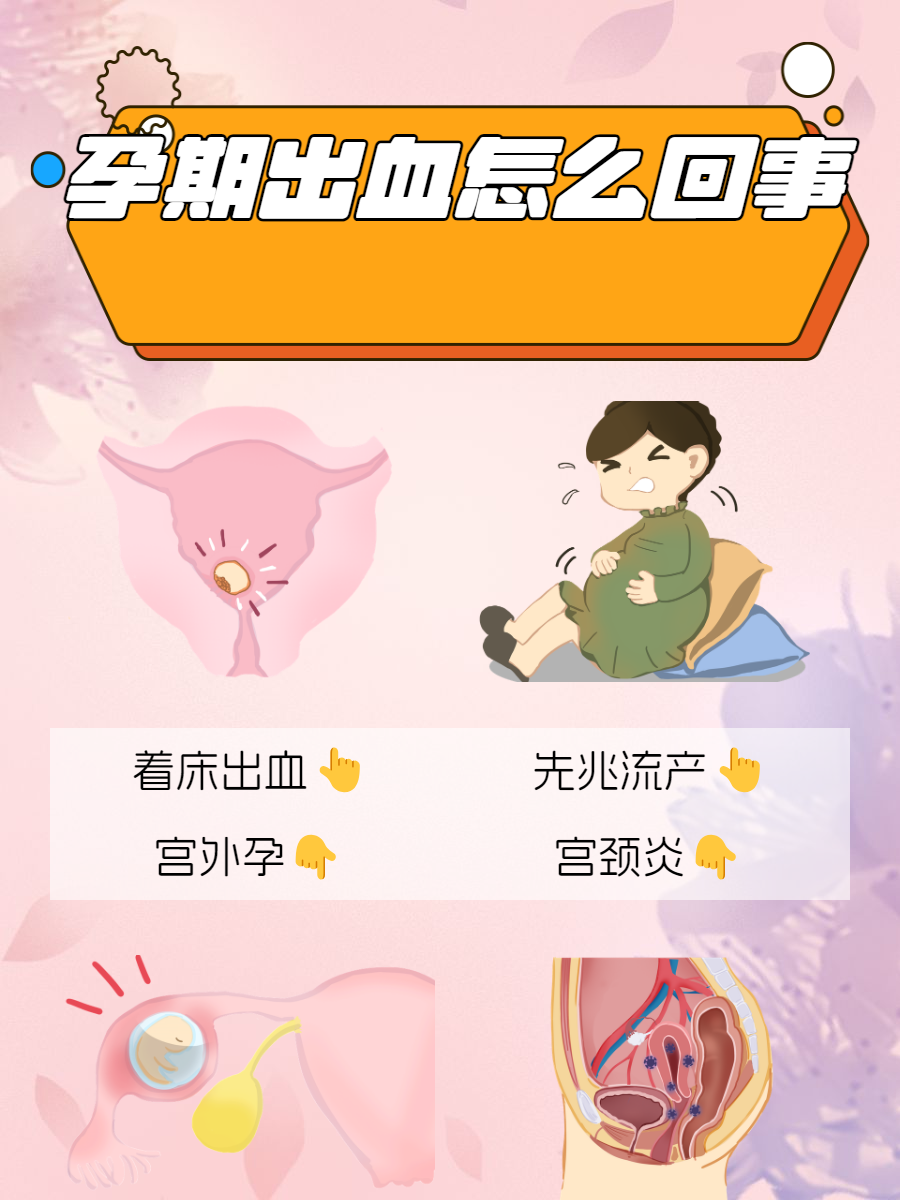 先兆流产应该怎么处理