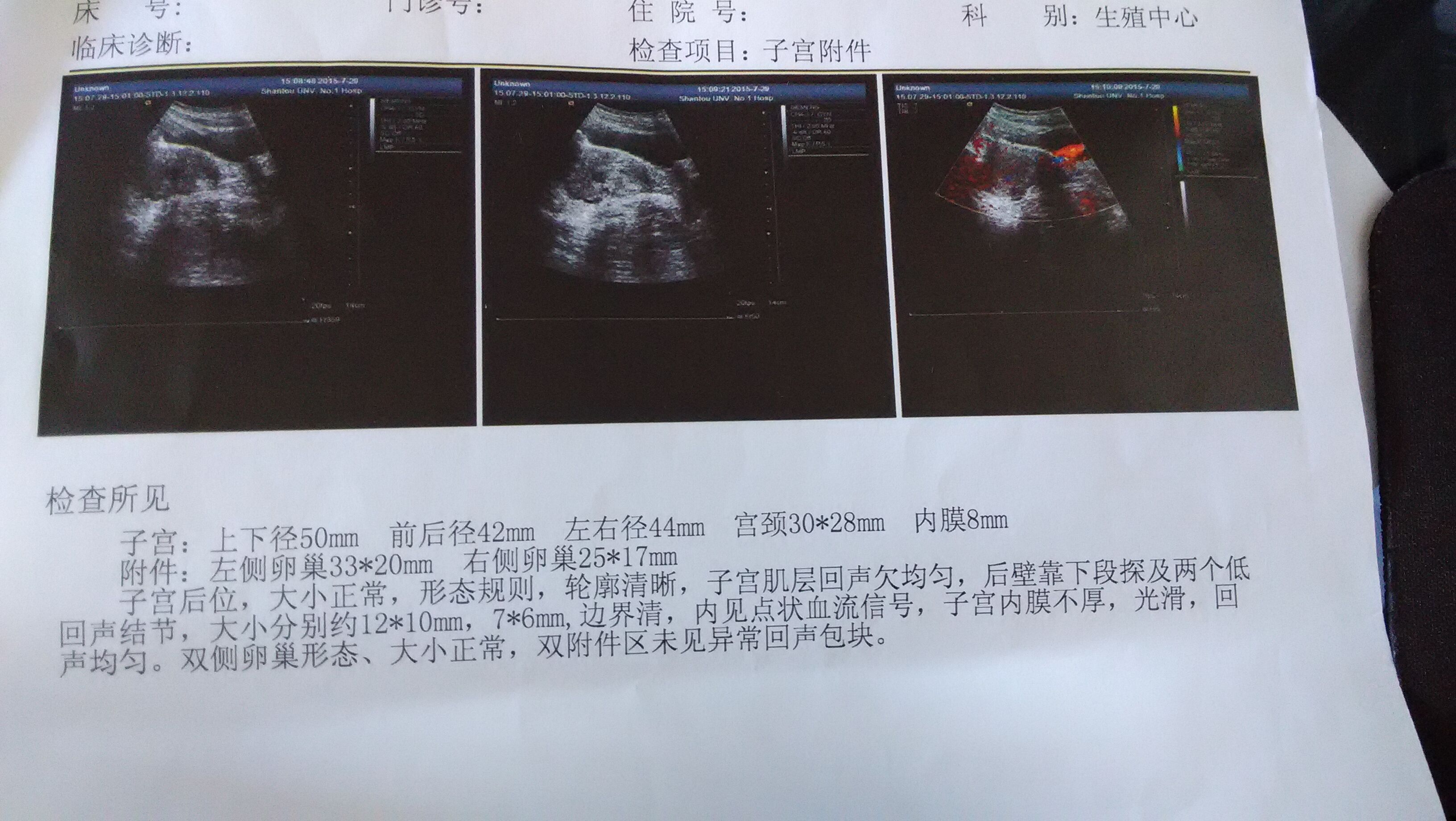 月经黑色的怎么回事