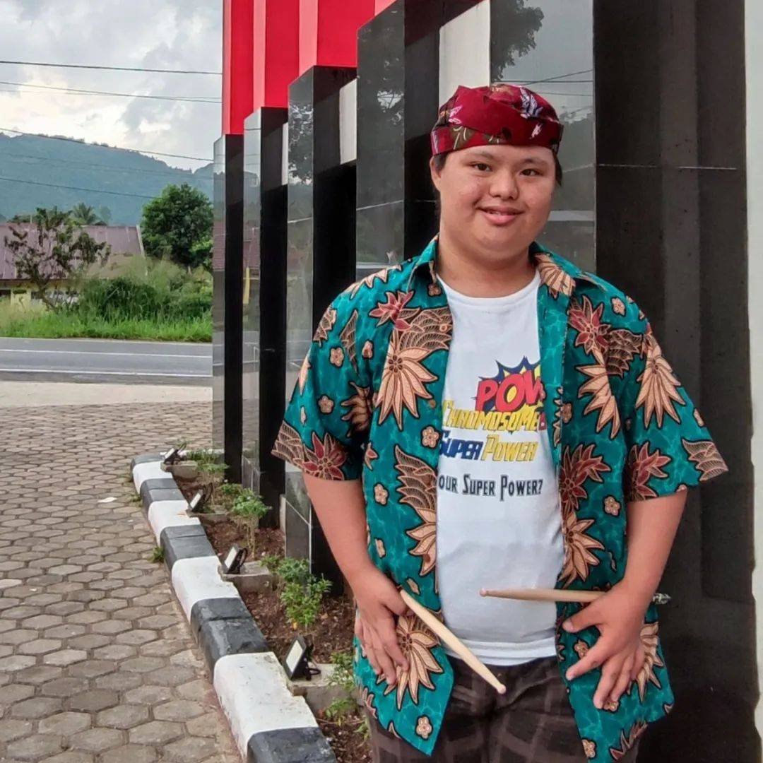 唐氏综合征婴儿的表现