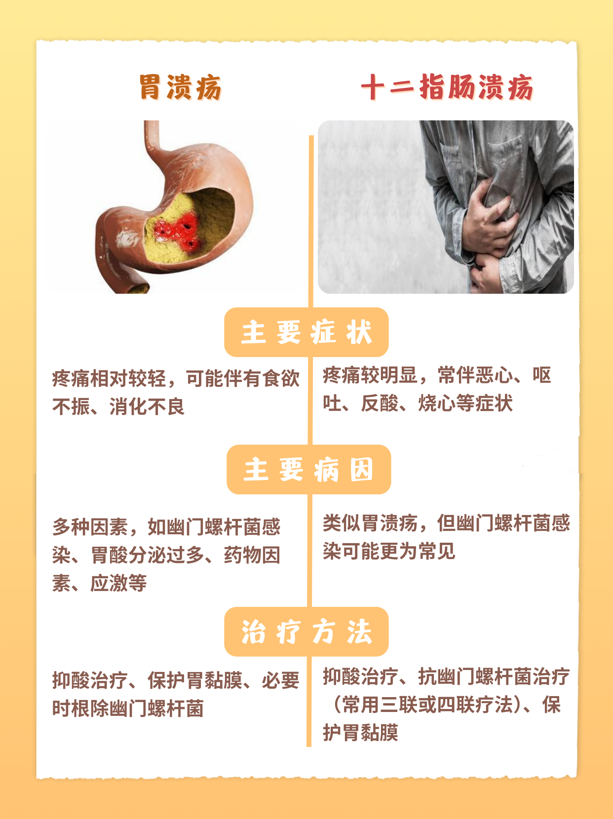 十二指肠溃疡的症状及治疗方法