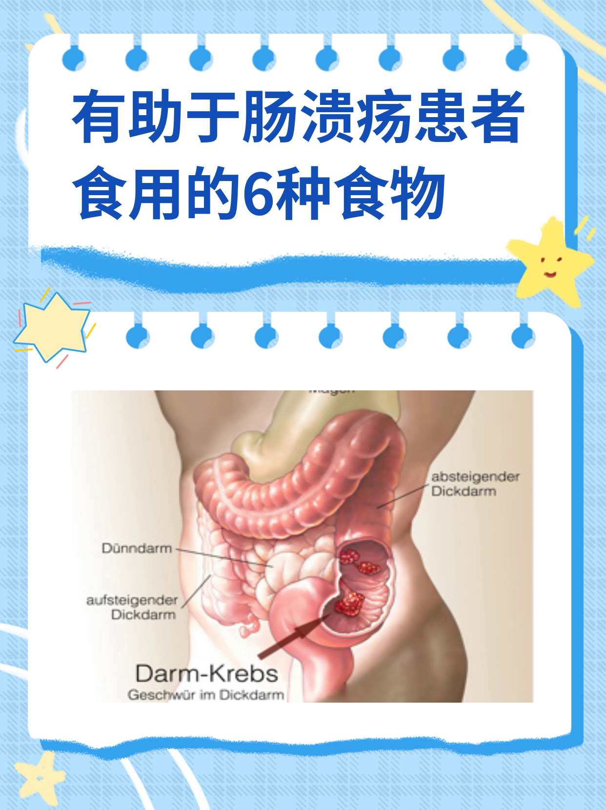 胃溃疡不能吃什么