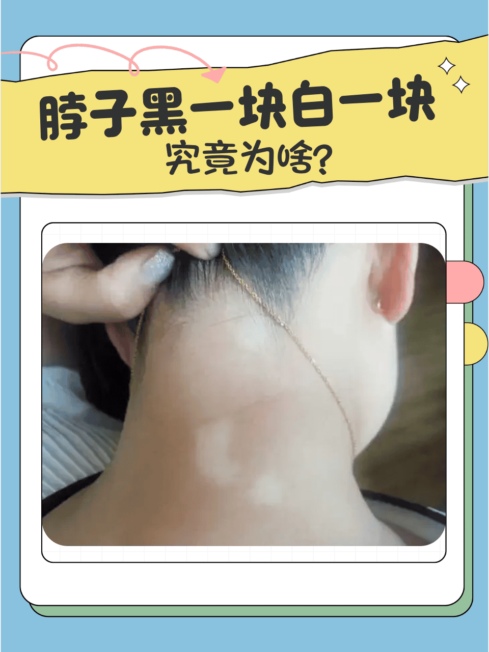 面色很黑,身上很白