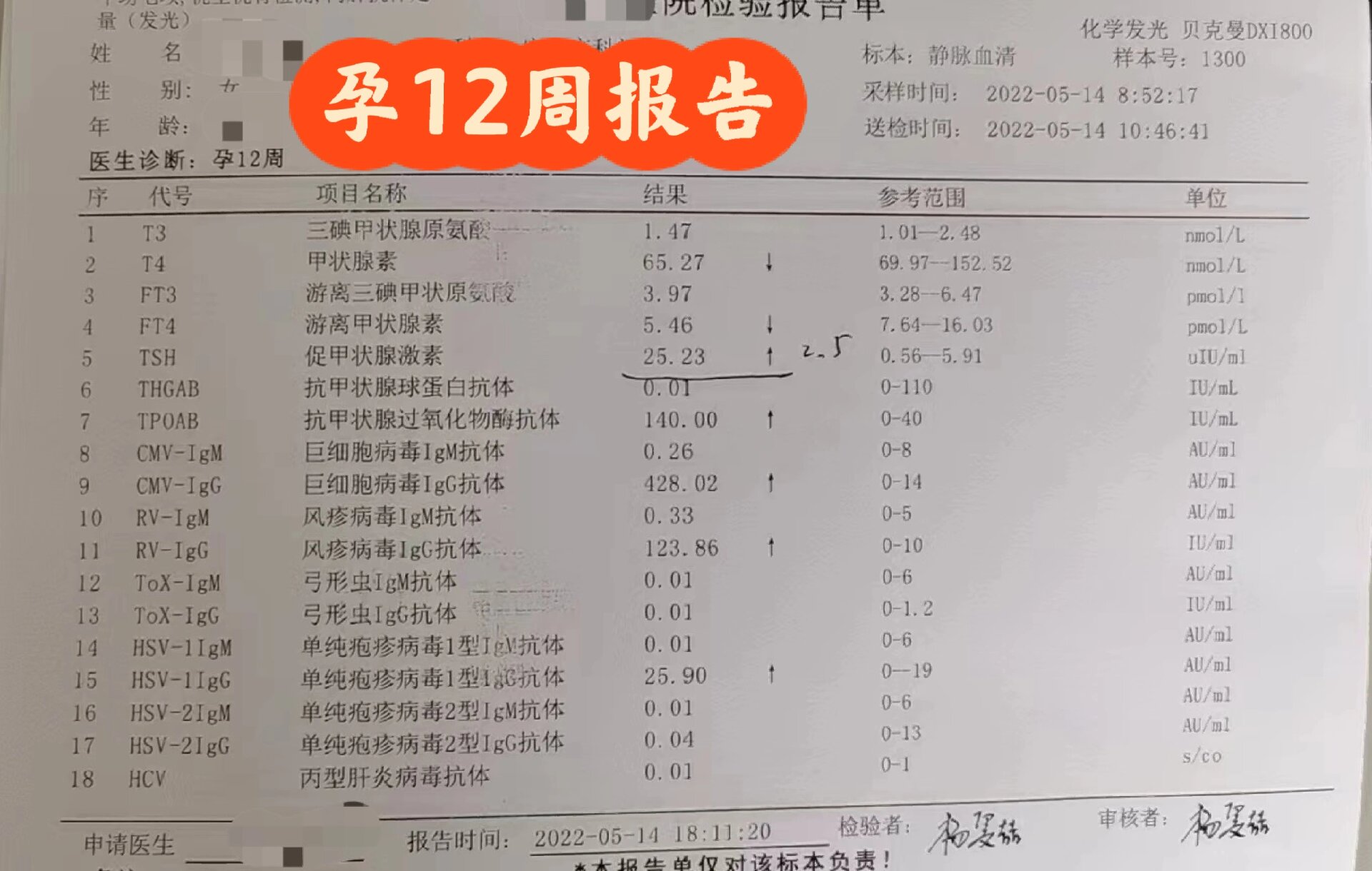 孕妇甲减多少才算严重呢