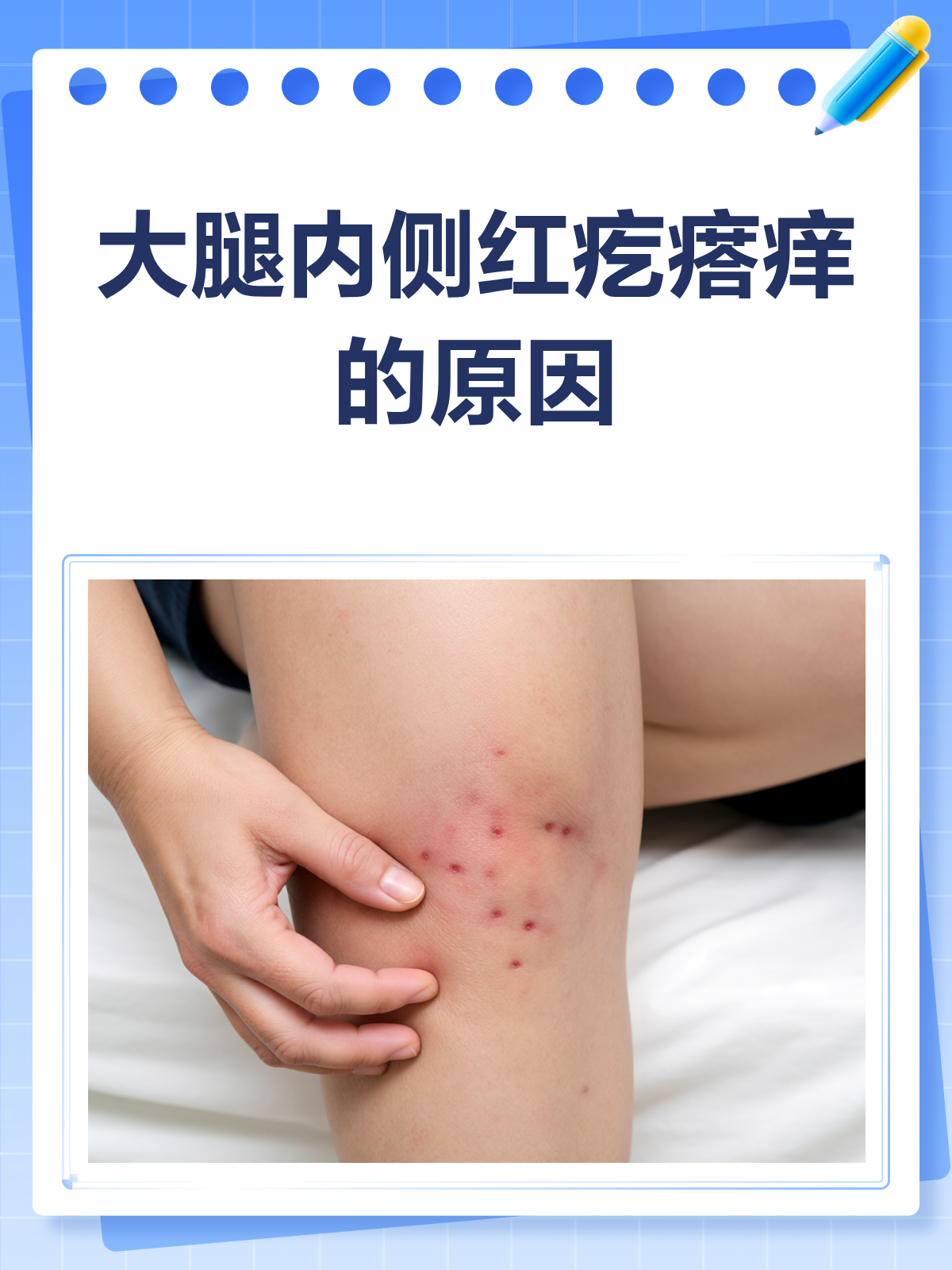 大腿根部红痒怎么办