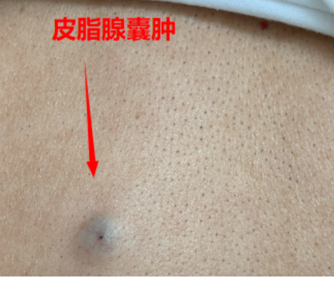 娄月怡 第2页