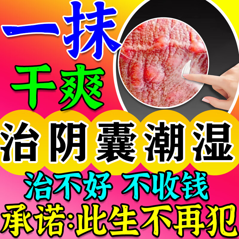 阴囊湿疹用什么药膏好?